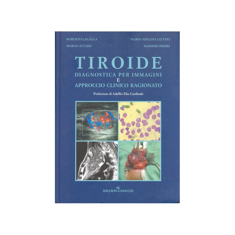 TIROIDE - Diagnostica per Immagini e Approccio Clinico Ragionato